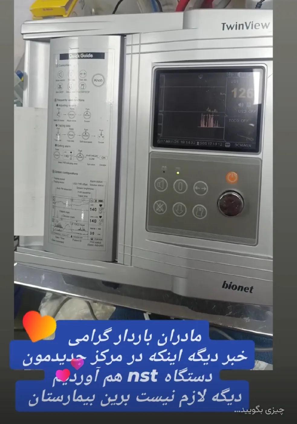 انجام nst با پیشرفته ترین دستگاه